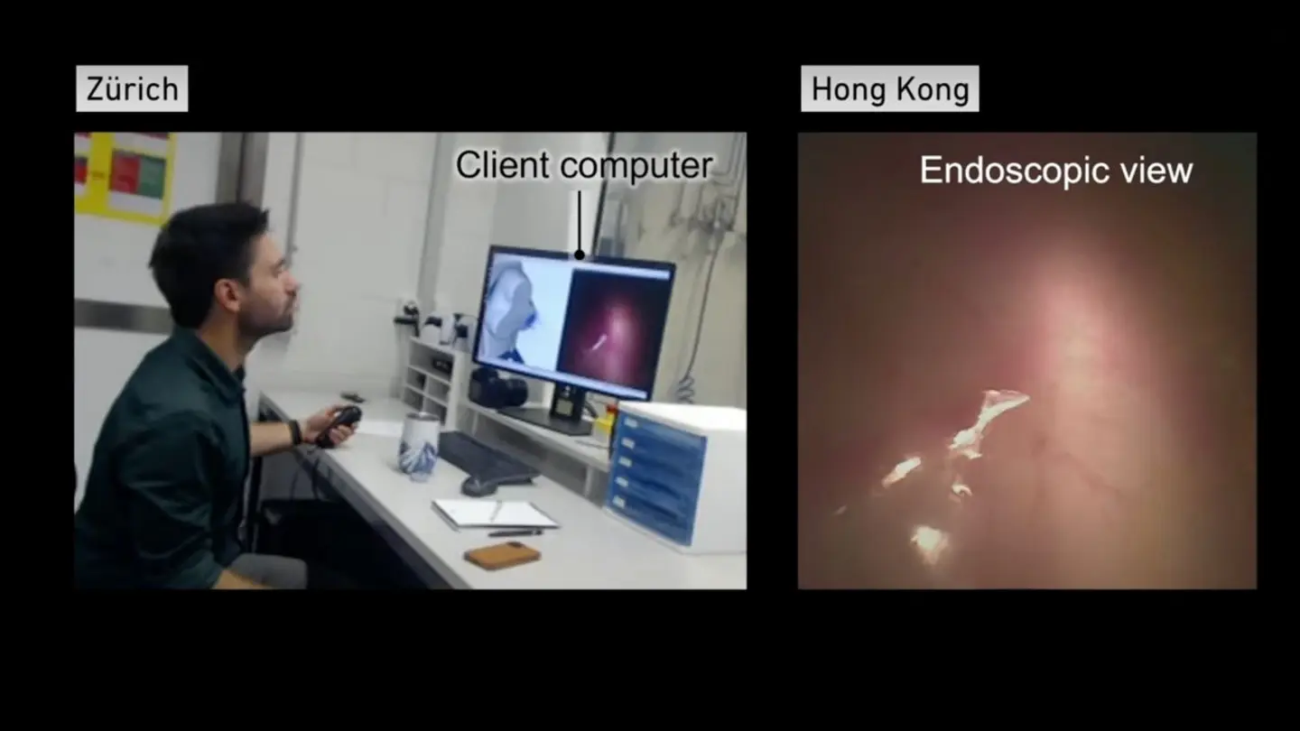 cirurgia de controle de playstation 